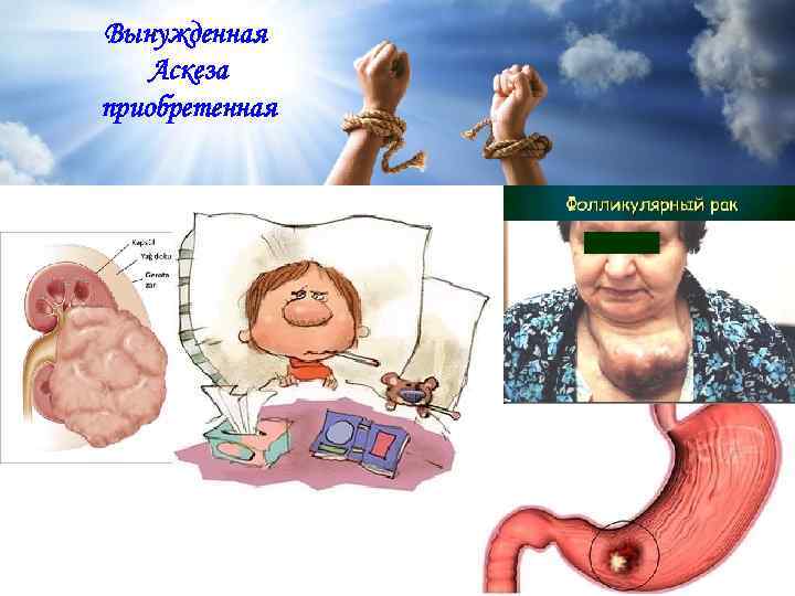 Вынужденная Аскеза приобретенная Самоограничение, сознательная борьба с зависимостями 