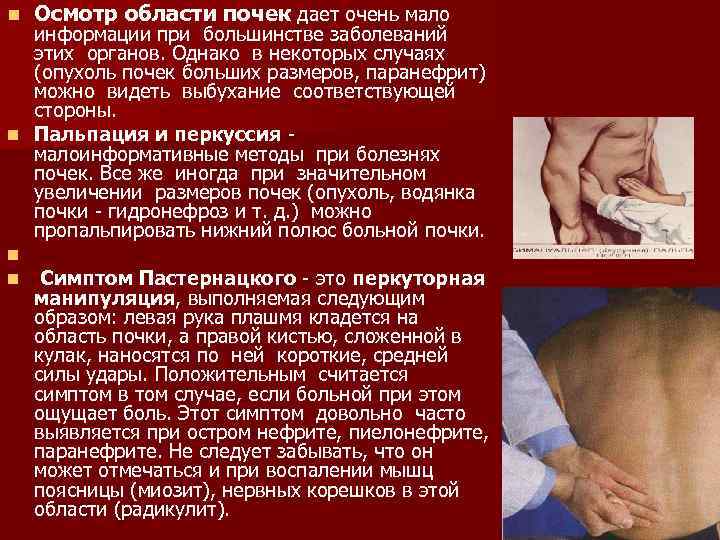 n Осмотр области почек дает очень мало информации при большинстве заболеваний этих органов. Однако