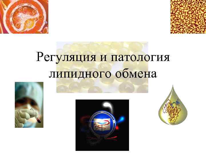 Регуляция и патология липидного обмена 