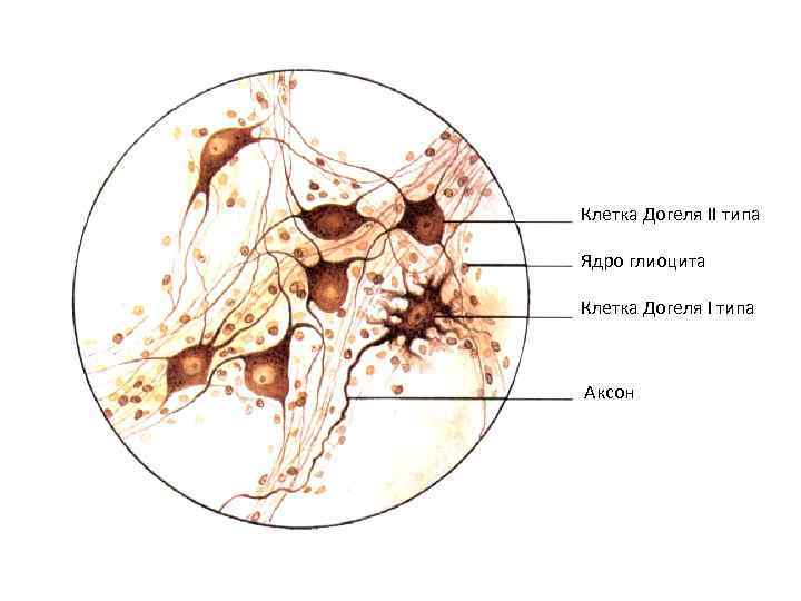 Клетка Догеля II типа Ядро глиоцита Клетка Догеля I типа Аксон 