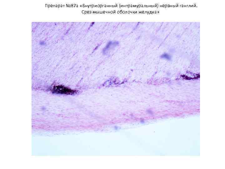 Препарат № 87 а «Внутриорганный (интрамуральный) нервный ганглий. Срез мышечной оболочки желудка» 