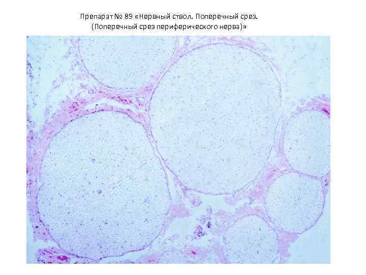 Препарат № 89 «Нервный ствол. Поперечный срез. (Поперечный срез периферического нерва)» 