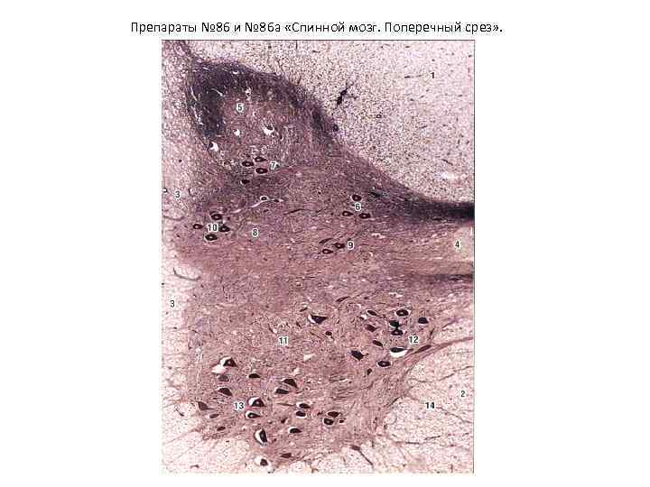Препараты № 86 и № 86 а «Спинной мозг. Поперечный срез» . 