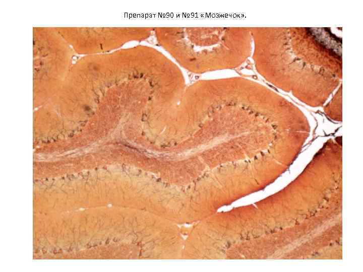 Препарат № 90 и № 91 «Мозжечок» . 