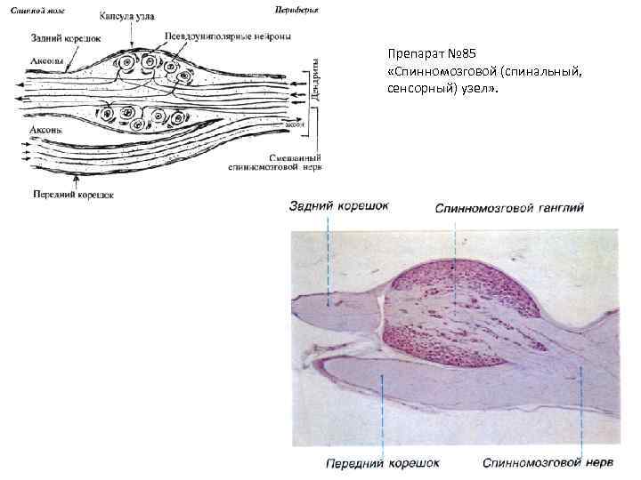 Препарат № 85 «Спинномозговой (спинальный, сенсорный) узел» . 
