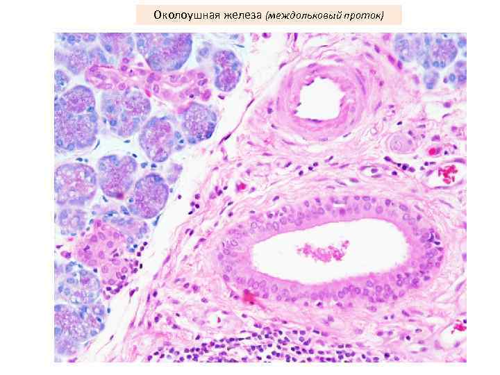 Околоушная железа (междольковый проток) 