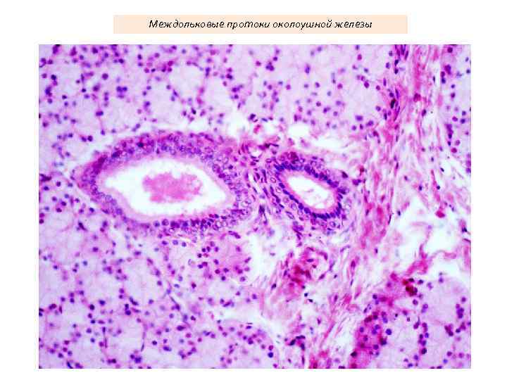 Междольковые протоки околоушной железы 