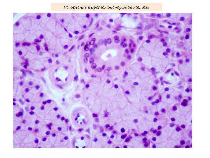 Исчерченный проток околоушной железы 