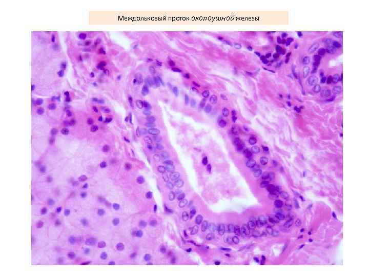 Междольковый проток околоушной железы 