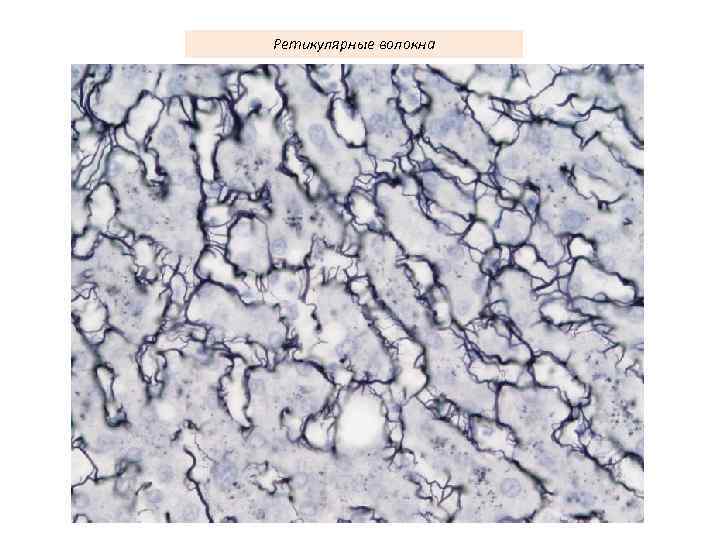 Ретикулярные волокна 