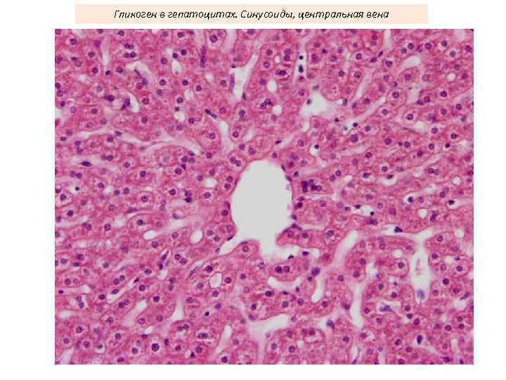 Гликоген в гепатоцитах. Синусоиды, центральная вена 