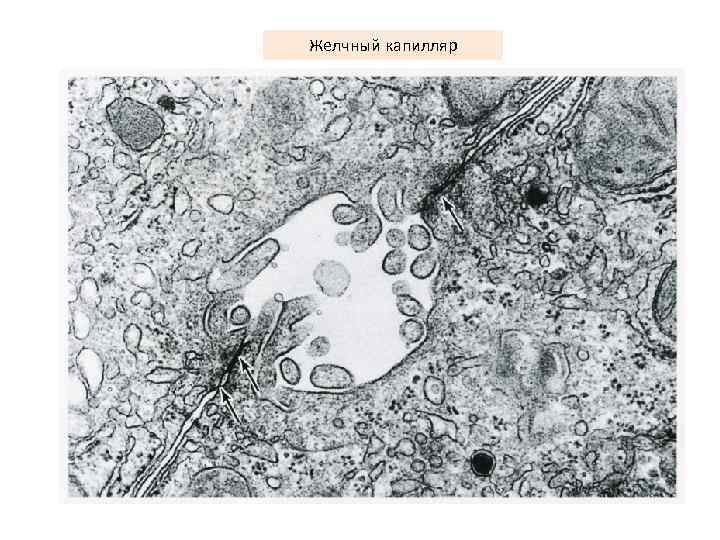 Желчный капилляр 