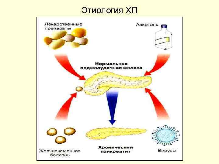 Этиология ХП 