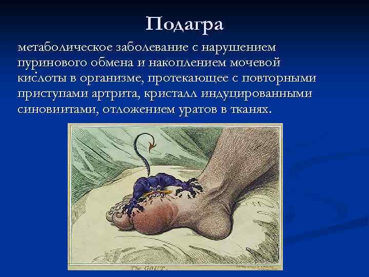 Подагра метаболическое заболевание с нарушением пуринового обмена и накоплением мочевой. кислоты в организме, протекающее