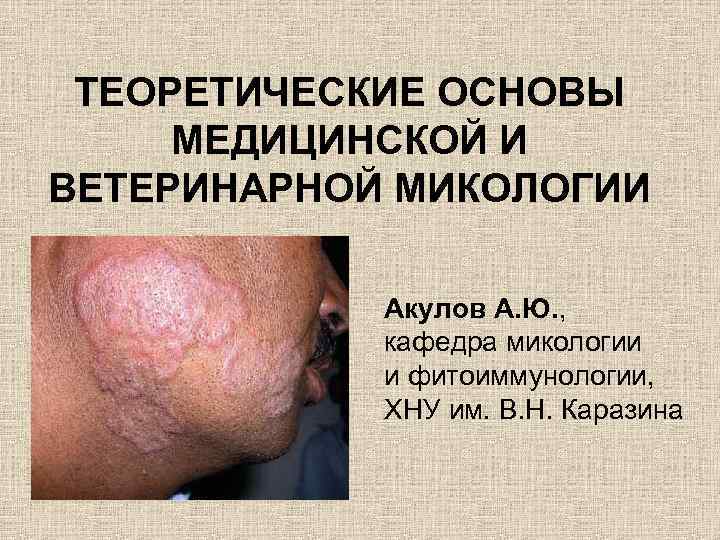ТЕОРЕТИЧЕСКИЕ ОСНОВЫ МЕДИЦИНСКОЙ И ВЕТЕРИНАРНОЙ МИКОЛОГИИ Акулов А. Ю. , кафедра микологии и фитоиммунологии,