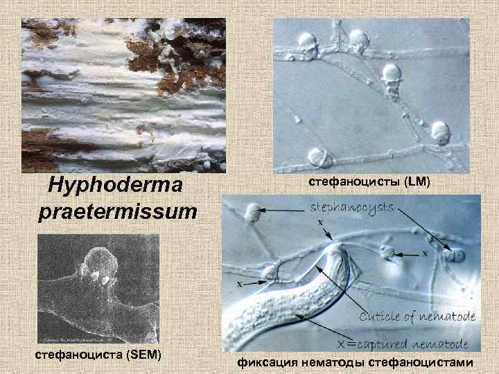 Hyphoderma praetermissum cтефаноциста (SEM) стефаноцисты (LM) фиксация нематоды стефаноцистами 