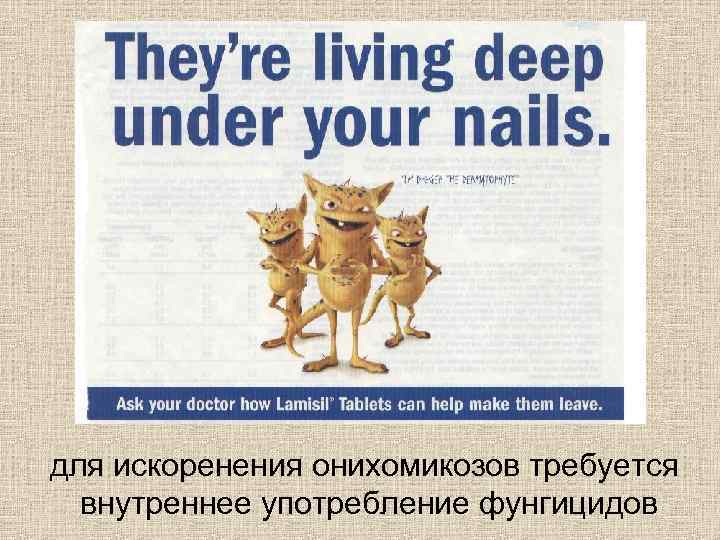 для искоренения онихомикозов требуется внутреннее употребление фунгицидов 