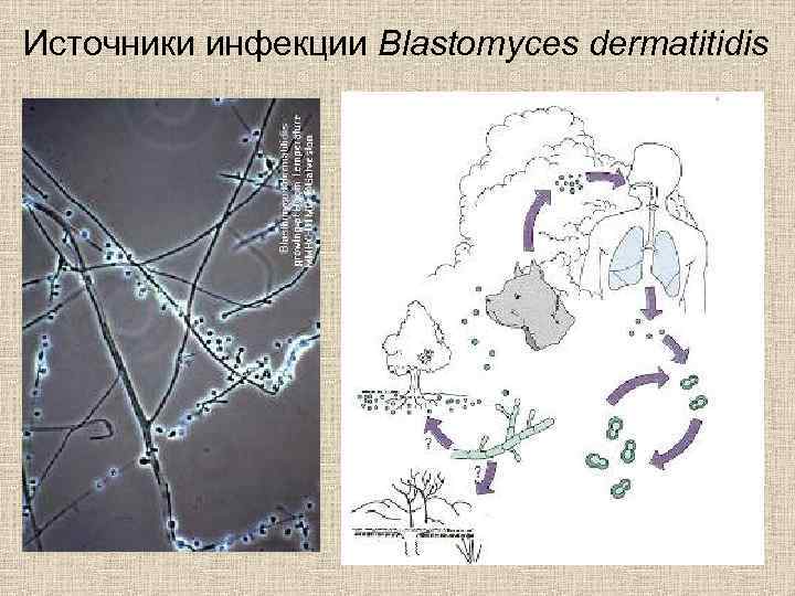 Источники инфекции Blastomyces dermatitidis 