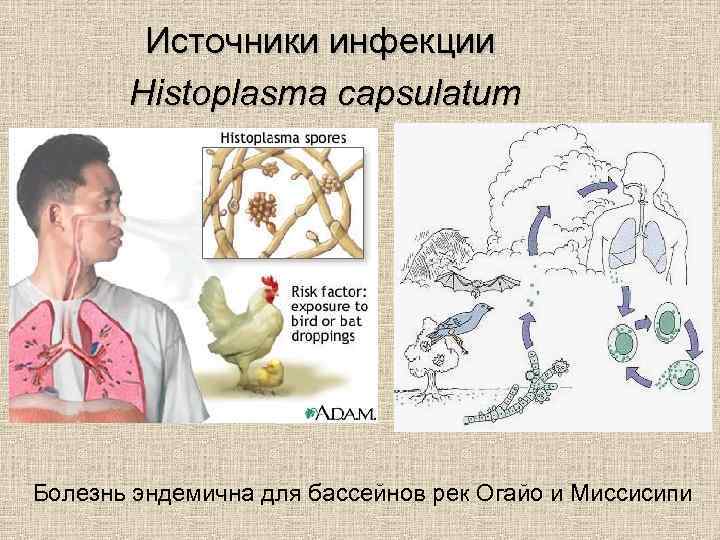Источники инфекции Histoplasma capsulatum Болезнь эндемична для бассейнов рек Огайо и Миссисипи 