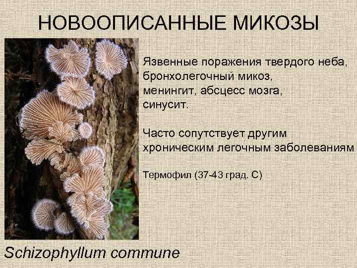 НОВООПИСАННЫЕ МИКОЗЫ Язвенные поражения твердого неба, бронхолегочный микоз, менингит, абсцесс мозга, синусит. Часто сопутствует