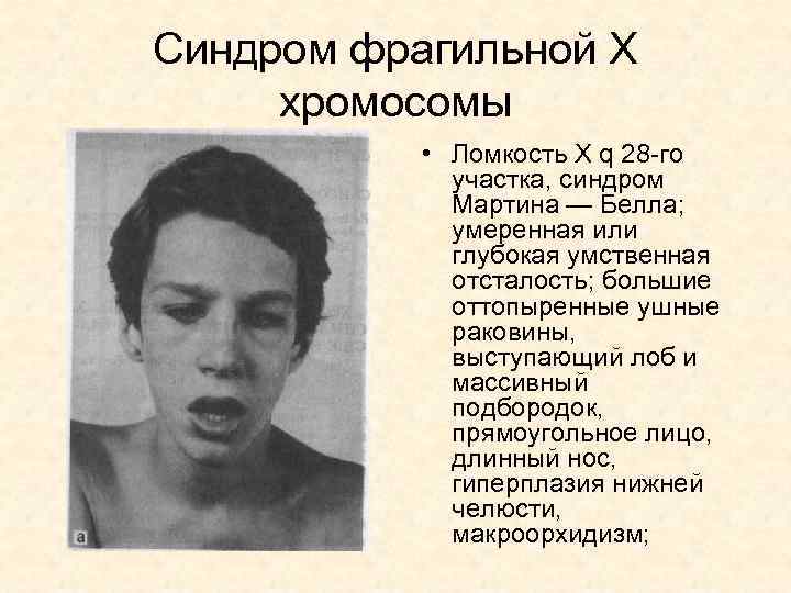 Существует такой термин синдром маугли см фотографию