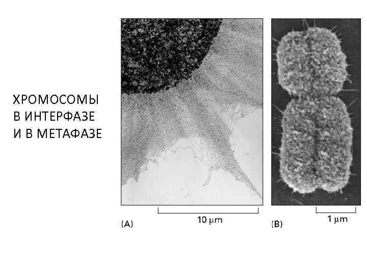 ХРОМОСОМЫ В ИНТЕРФАЗЕ И В МЕТАФАЗЕ 