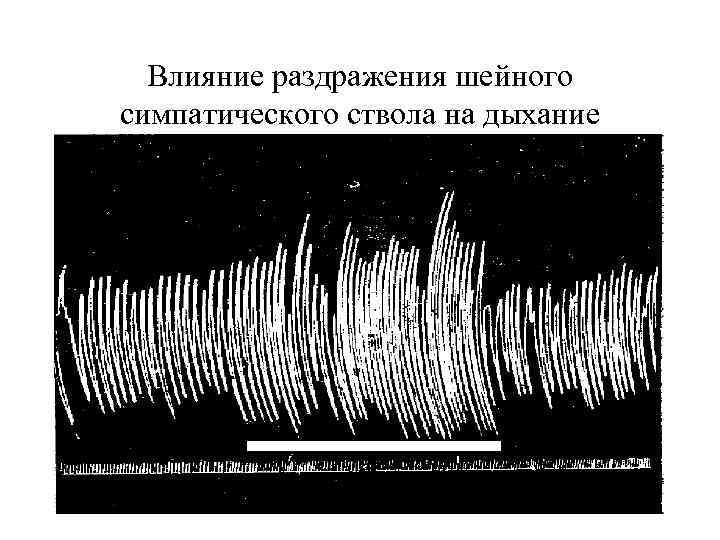 Влияние раздражения шейного симпатического ствола на дыхание 