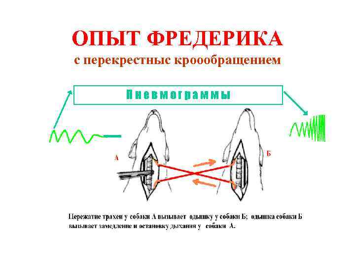 ОПЫТ ФРЕДЕРИКА с перекрестныс кроообращением Пневмограммы 