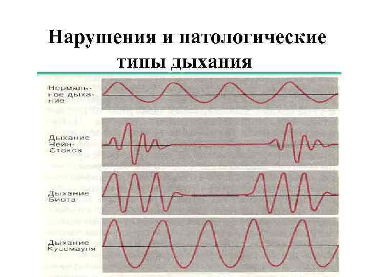 Нарушения и патологические типы дыхания 