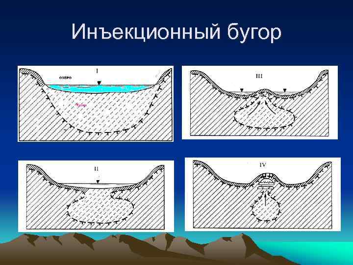 Инъекционный бугор 