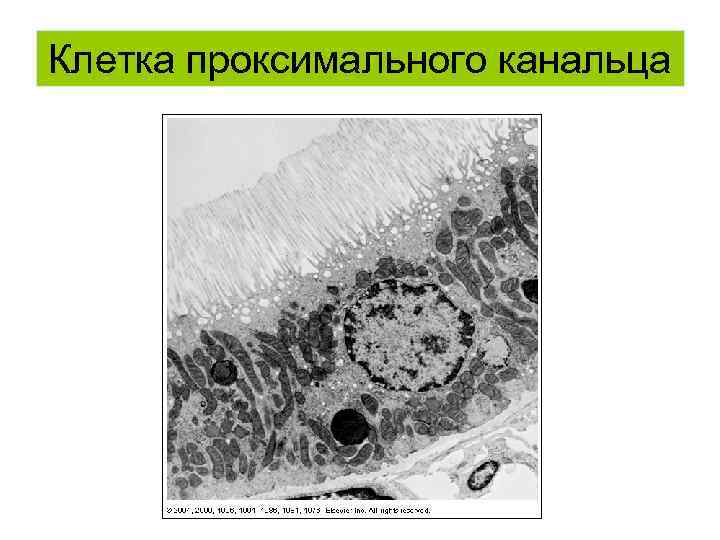 Клетка проксимального канальца 