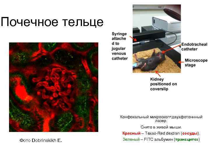Почечное тельце Конфокальный микроскоп+двухфотоннный лазер. Снято в живой мыши. Красный – Texas-Red dextran (сосуды).