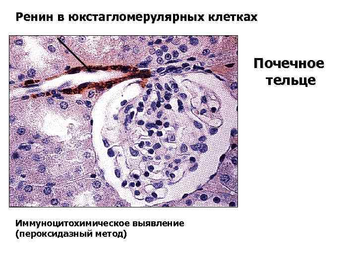 Ренин в юкстагломерулярных клетках Почечное тельце Иммуноцитохимическое выявление (пероксидазный метод) 