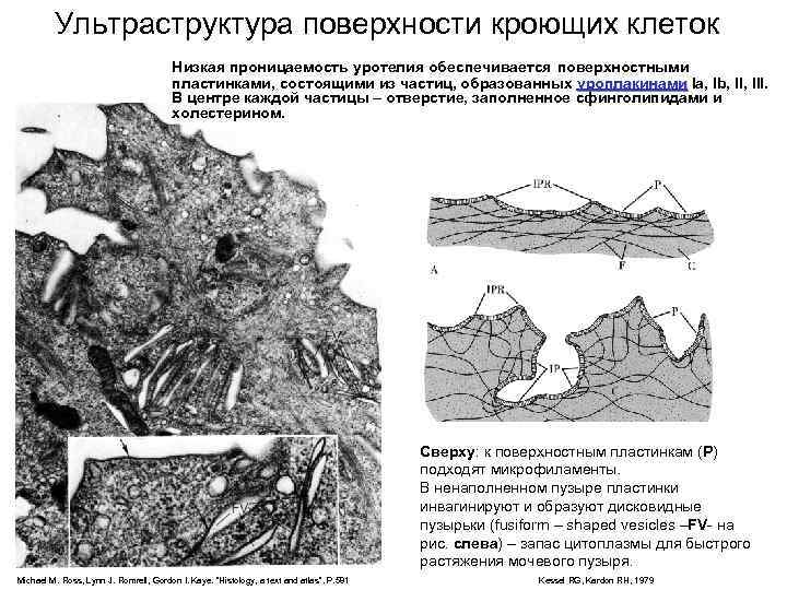 Ультраструктура поверхности кроющих клеток Низкая проницаемость уротелия обеспечивается поверхностными пластинками, состоящими из частиц, образованных