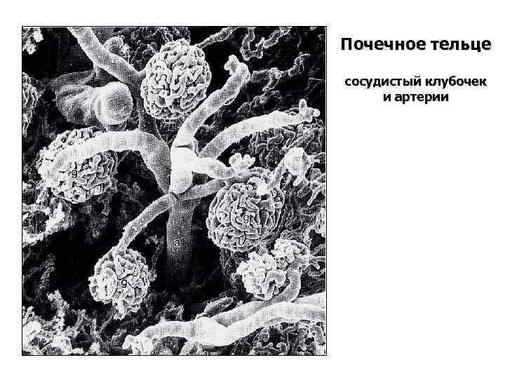 Почечное тельце сосудистый клубочек и артерии 