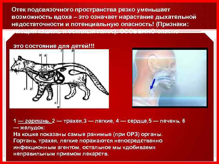 Отек подсвязочного пространства резко уменьшает возможность вдоха – это означает нарастание дыхательной недостаточности и