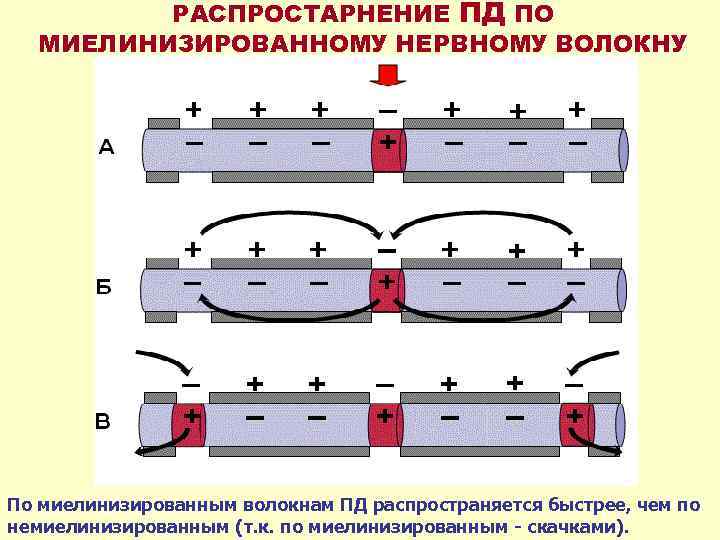 РАСПРОСТАРНЕНИЕ ПД ПО МИЕЛИНИЗИРОВАННОМУ НЕРВНОМУ ВОЛОКНУ По миелинизированным волокнам ПД распространяется быстрее, чем по