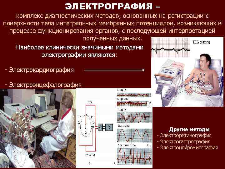 Электрография экг один из важных методов