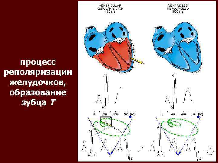 процесс реполяризации желудочков, образование зубца T 