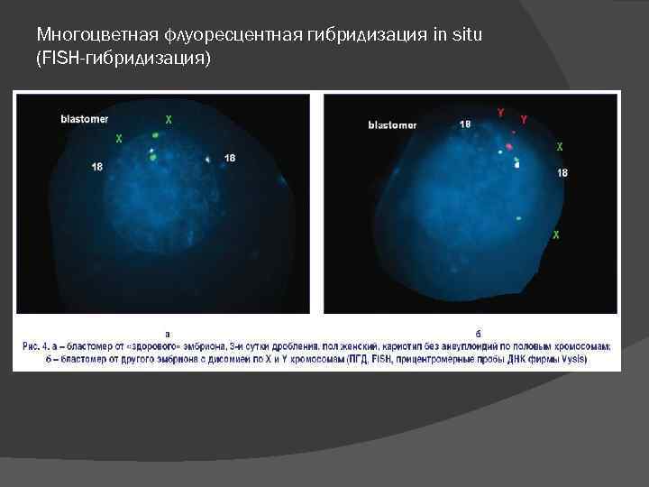 Многоцветная флуоресцентная гибридизация in situ (FISH-гибридизация) 