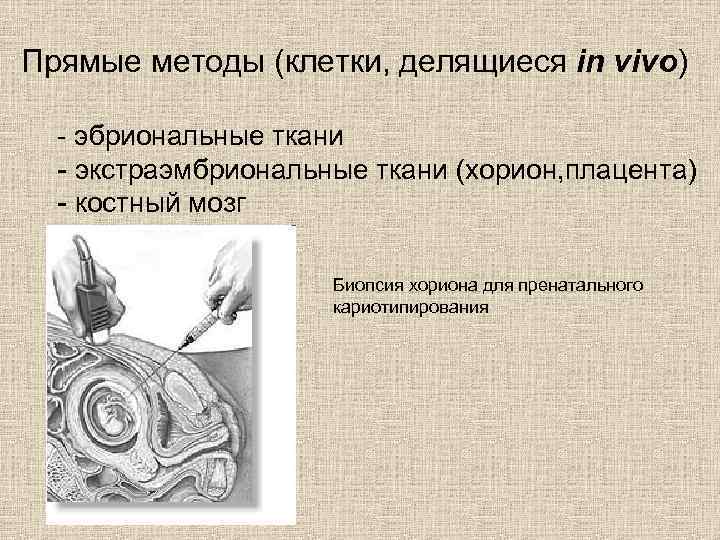 Прямые методы (клетки, делящиеся in vivo) - эбриональные ткани - экстраэмбриональные ткани (хорион, плацента)
