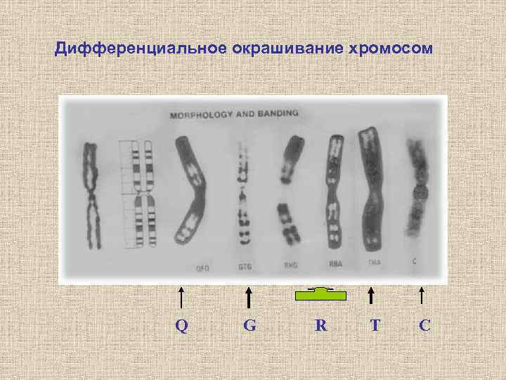 Изменение окраски хромосом. Метод дифференциального окрашивания хромосом. Методы дифференциальной окраски хромосом. Дифференциальное окрашивание хромосом. Дифференциальная окраска хромосом.