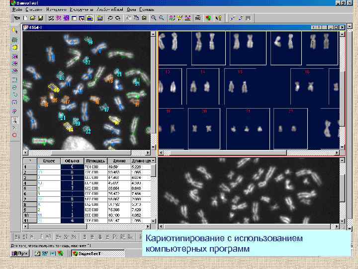 Кариотипирование с использованием компьютерных программ 