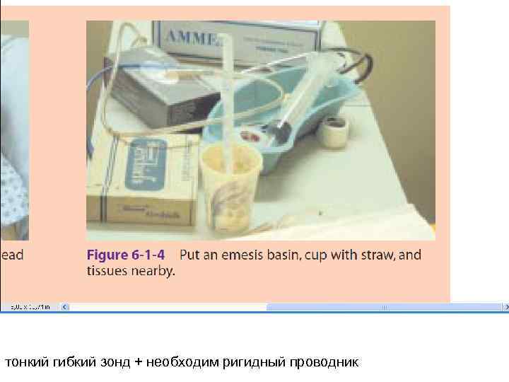 тонкий гибкий зонд + необходим ригидный проводник 