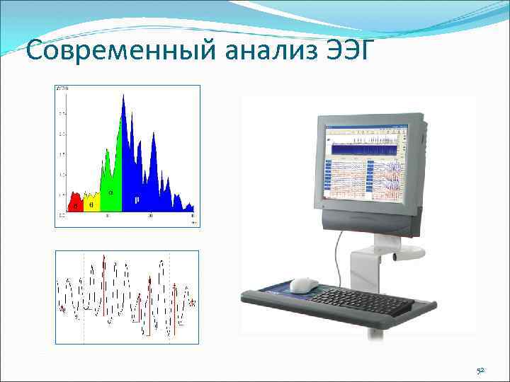 Современный анализ ЭЭГ 52 