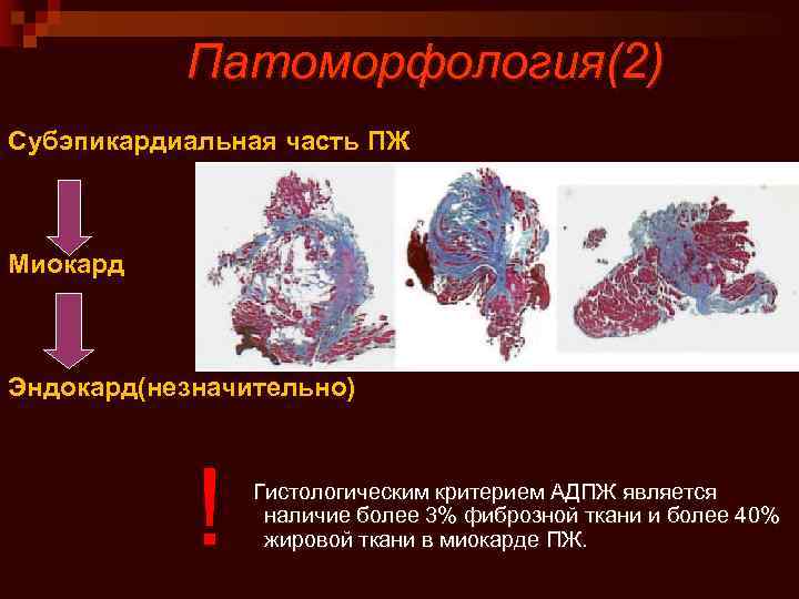 Аритмогенный шок карта вызова