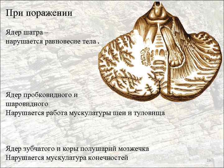 При поражении Ядер шатра – нарушается равновесие тела. Ядер пробковидного и шаровидного Нарушается работа