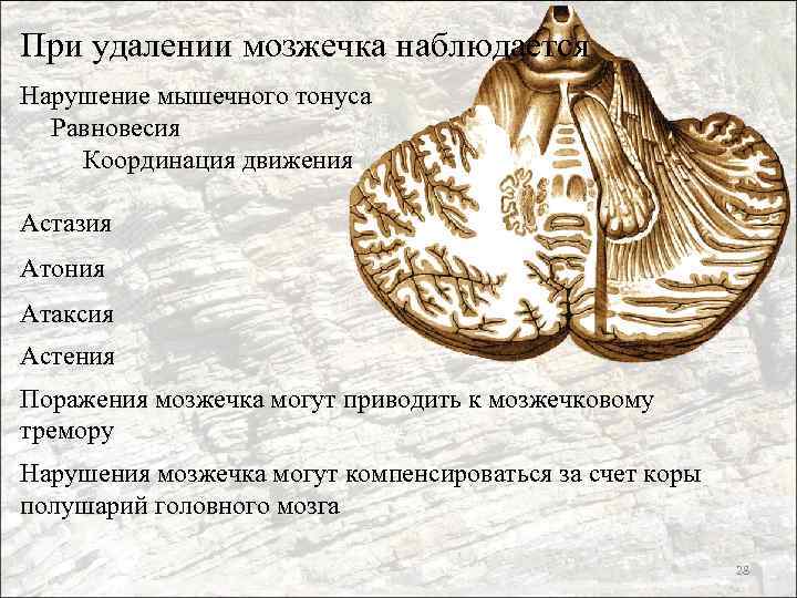 При удалении мозжечка наблюдается Нарушение мышечного тонуса Равновесия Координация движения Астазия Атония Атаксия Астения