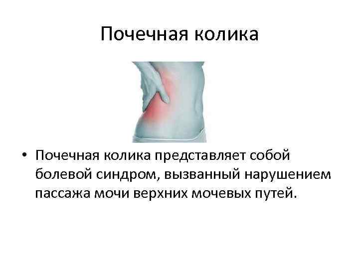 Почечная колика • Почечная колика представляет собой болевой синдром, вызванный нарушением пассажа мочи верхних