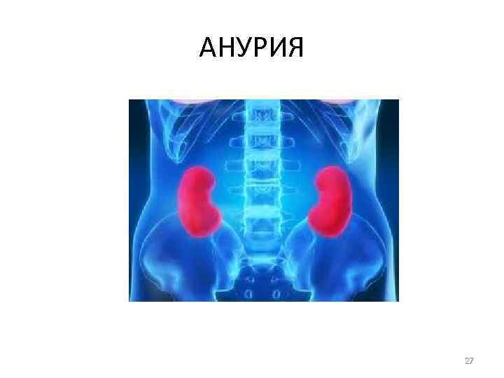 АНУРИЯ 27 